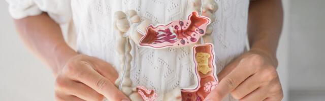 Kolorektaalvähk on juba mitmendat aastat USA alla 50aastaste esimene vähisurma põhjus