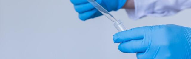 OSKA prognoosib väikese hõivega farmaatsiatööstuses olulist kasvu