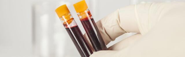 Naine paranes HIVist tänu tüvirakkude siirdamisele