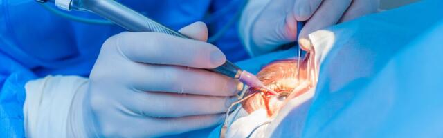 Ambulatoorse ja päevakirurgia osakaal kasvab