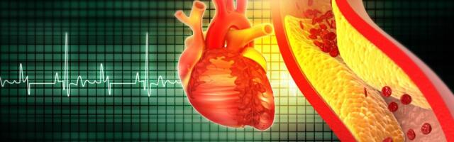 Soome uuring: koronaararterite tõve teket mõjutab 12 rakutüüpi