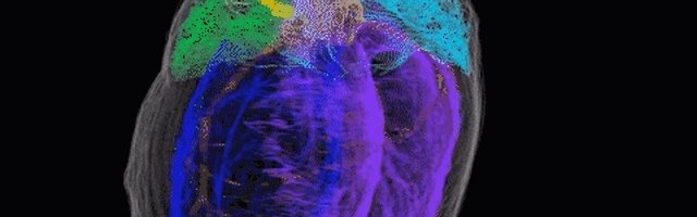 LIIKUV PILT | See on esimene ruumiline kaart südame "ajust"