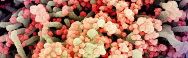 Koroonaviirus elab nahal viis korda kauem kui gripp: uuring
