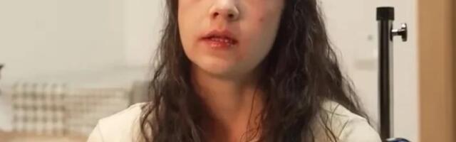 "ŽIVOT PRIPADA BOGU, NE NAMA" Gosti emisije "Puls Srbije" o slučaju eutanazije Noelije Kastiljo Ramos za Kurir: "Umiranje po svojoj prirodi nije dostojanstveno"