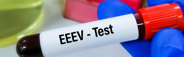 USAs suri inimene hobuste entsefaliidi tõttu