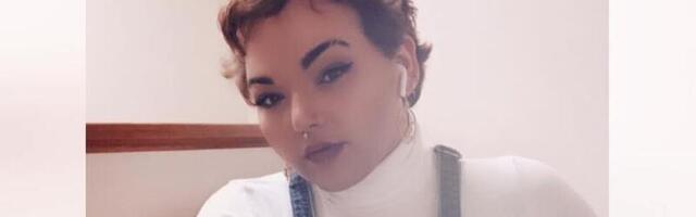 Võimsa karvakasvuga naine räägib avameelselt oma haigusest