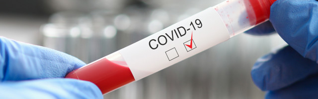 Koroonaviirus Eestis, 12. august 2021: ööpäevaga lisandus 378 positiivset