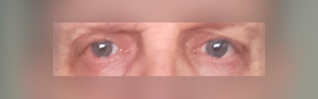 SILMAD VAJAVAD TOITU!