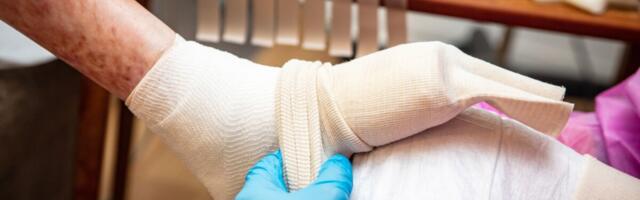 Paraneb harvaesineva raske nahahaiguse raviks vajalike haavasidemete kättesaadavus