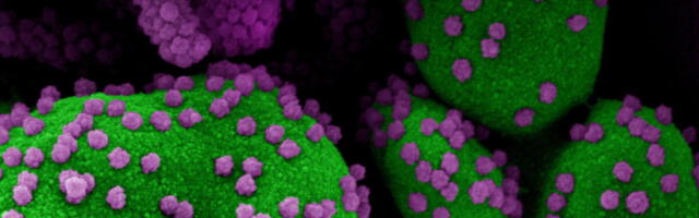 Deltaviirusel tekkis peavalu valmistav alamvariant ja see murdis tõhusalt ka Eestisse