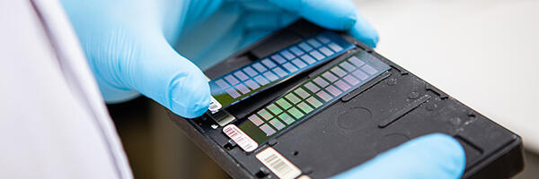 Eesti viib geeniandmed tervishoidu – uus seadus loob aluse 21. sajandi personaalmeditsiinile  