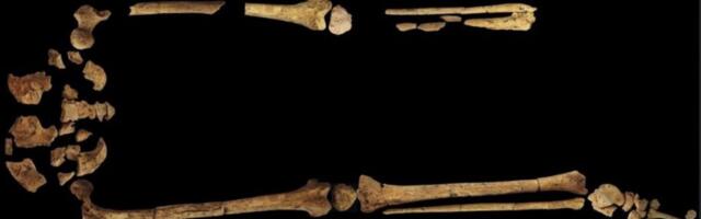 Teadlased leidsid varaseima tõendi kirurgilise amputatsiooni kohta