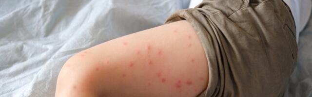 Läti Waldorfi koolis on kinnitatud 14 leetrijuhtu