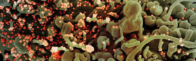 Ülikool: Eestis uuritud koroonaviirus pärineb Põhja-Itaaliast