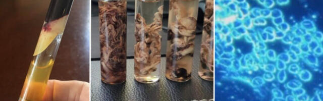 Kiulised trombid, võõrkehad veres pärast COVID-torkimist: kas on olemas viis võõrutusraviks?