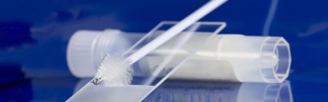 Kodus testimise võimalus tõi rohkem naisi sõeluuringule