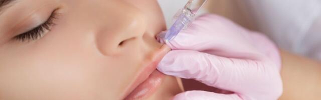 Põhjanaabrid tahavad senisest sagedamini huulte täiteainetest lahti saada