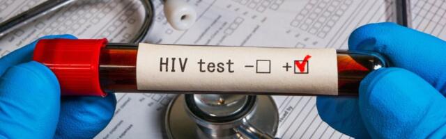 HIV testimisnädalal kutsutakse inimesi tasuta testima