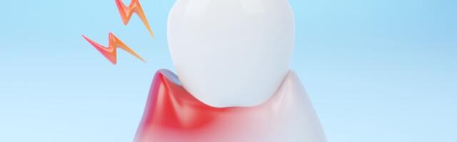 Soomes on parodontiidist kujunenud märkimisväärne rahvahaigus