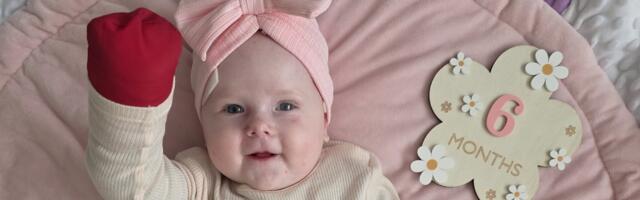 Palun aita kuuekuusel Emmal valuvabalt elada – ülikarmi nahka haarava geenihaigusega pisitüdruku ravi jätkamiseks on vaja 142 000 eurot