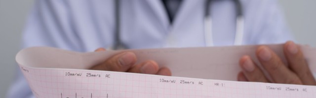 Uus meetod aitab vähendada rütmihäirete esinemist pärast infarkti