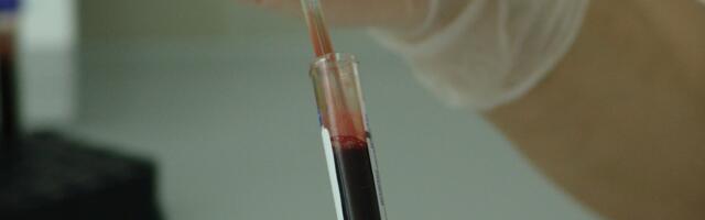 Uued uuringud: “turbovähk” pärast COVID-19 vaktsineerimist?