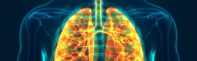 Soome teadlased leidsid uut teave kortisooni ja interferooni mõju kohta kopsukahjustustele