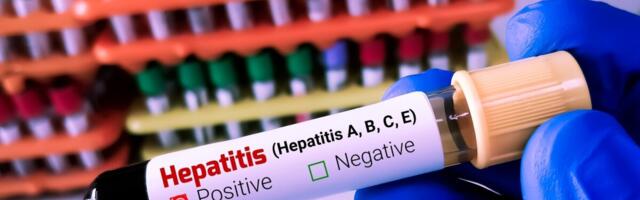 A-viirushepatiidi nakkus Eestis on sageli seotud reisimisega