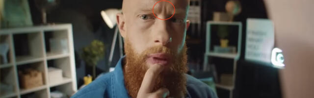 Millise inimolendiga on tegemist, kellel tugevad nahavoldid kahe kulmu vahel