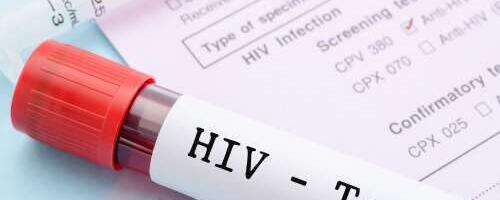 Nakatuda võib igaüks – TAI kutsub HIV-testima