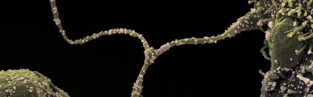 Sündinud on uus rahvusvahelist peavalu valmistav koroonatüvi