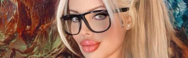 53 iluoperatsiooni teinud modell kahetseb: arstid ja ilukirurgid hoiatasid mind...